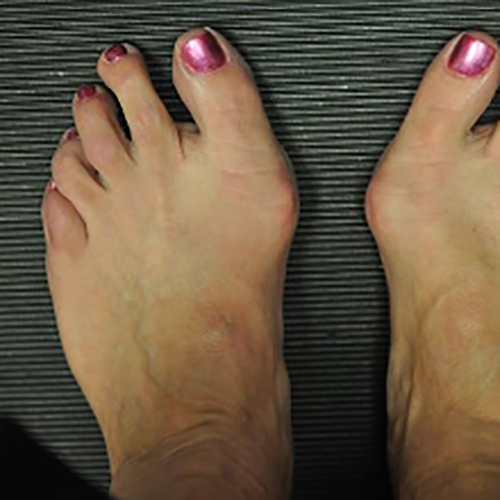 Les meilleures bottes de randonnée pour les oignons